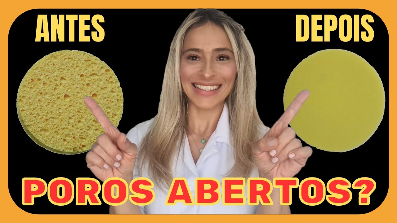 Poros Abertos e Cravinhos no Nariz? Veja o MELHOR TRATAMENTO da Atualidade!