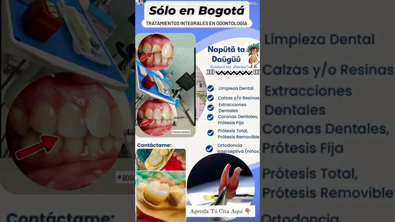 Servicio de Odontolog&iacute;a #odontologia #citas #atenci&oacute;n #salud #bajocosto #dentistry