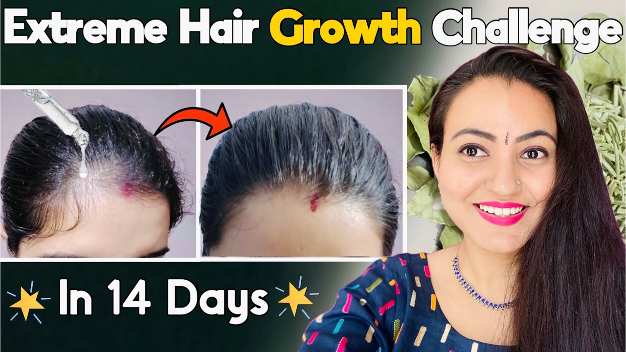 14 Days *Extreme Hair Growth* Challenge : Strongest Remedy to Grow Hair Faster, Longer & Thicker❤️