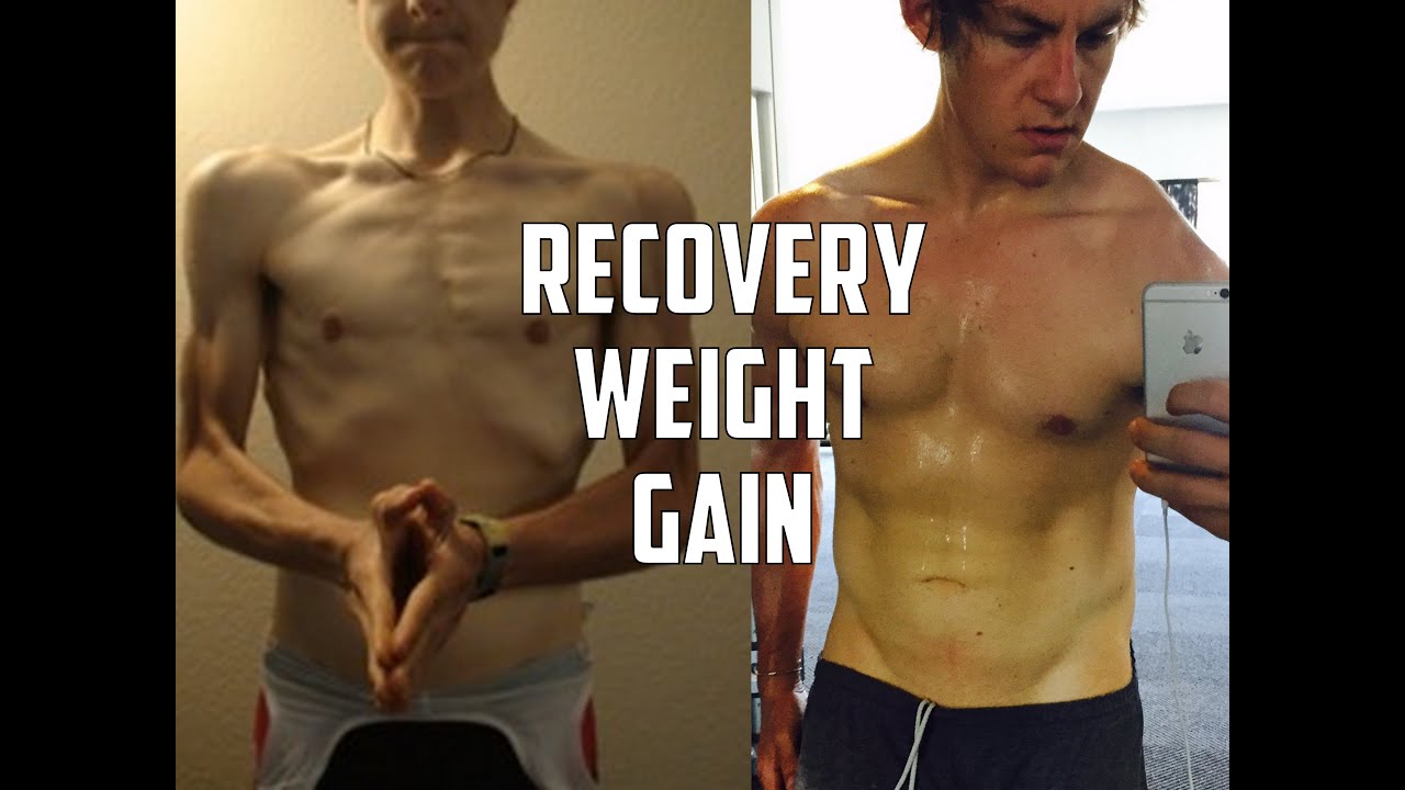ED Chat | WEIGHT GAIN In Recovery