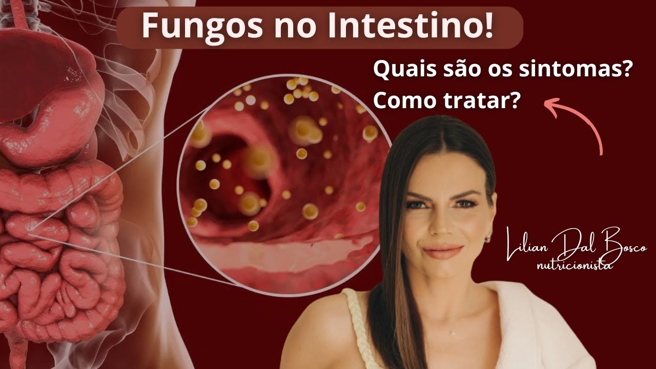 Fungos no Intestino - Quais são os sintomas e Como tratar! Nutricionista Lilian Dal Bosco