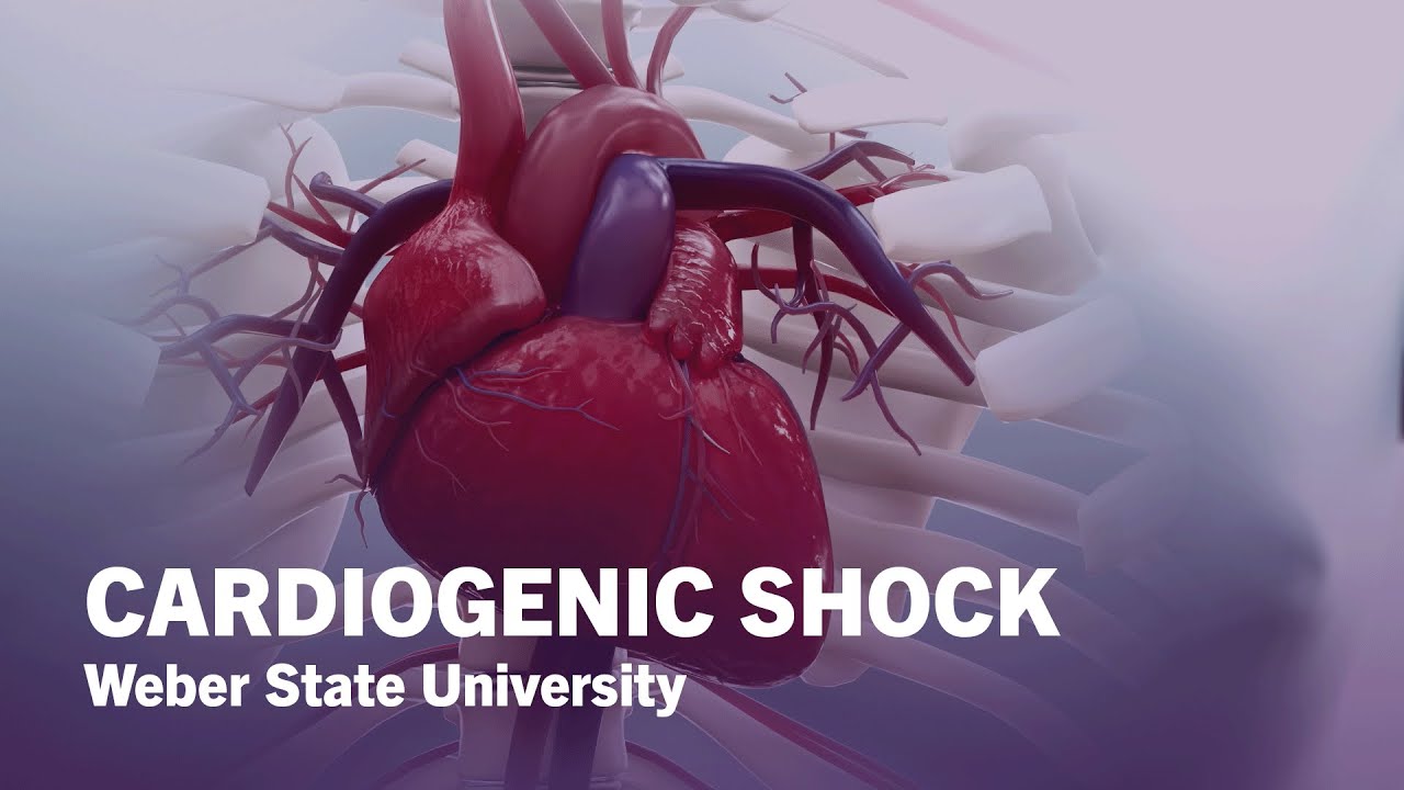 What is Cardiogenic Shock? - Weber State University