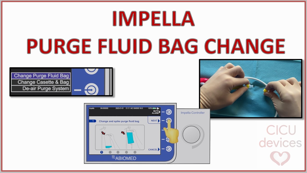 HOW TO CHANGE THE IMPELLA PURGE FLUID BAG, STEP BY STEP NURSING CARE (IMPELLA GUIDE 013)