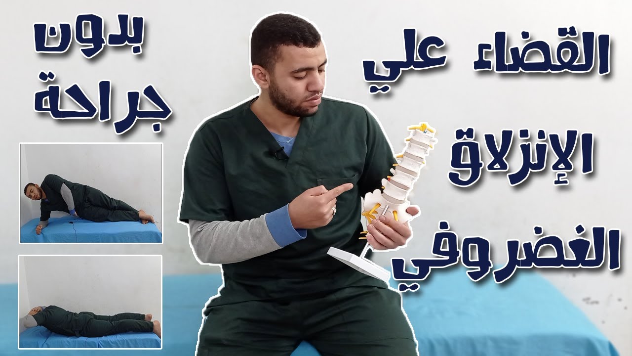 القضاء علي الانزلاق الغضروفي القطني نهائياً بدون جراحة | تمارين علاج غضروف الضهر(الفقرات القطنية)