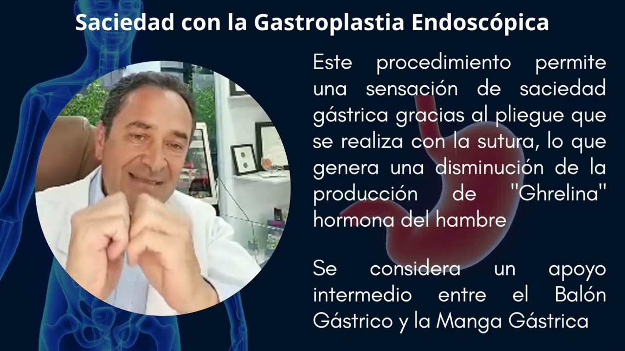 ¡Gastroplastia Endoscópica - Una nueva técnica para apoyar el tratamiento del Sobrepeso y Obesidad!