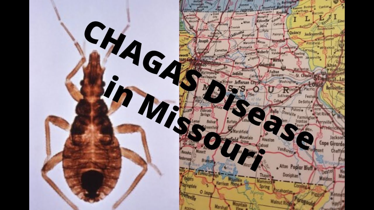Chagas disease: 1st local transmission in Missouri