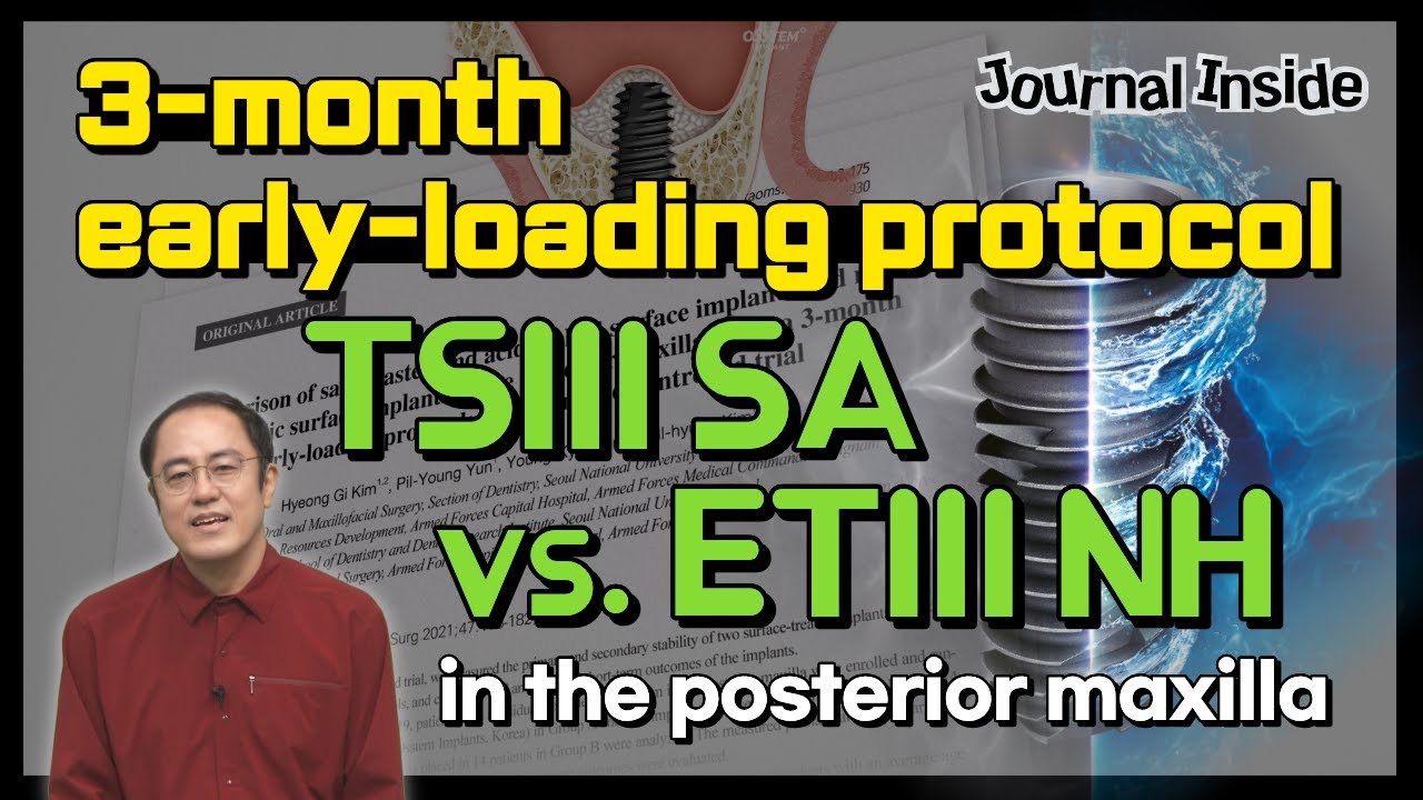 [Journal Inside] Comparison of SA and NH implants with 3-month early loading (AI Voice-over)