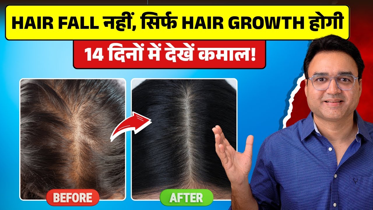 कितने भी पतले कमज़ोर झड़ते बाल हों, दोगुनी तेज़ी से उगेंगे | 4 Best Remedies For Hair Fall