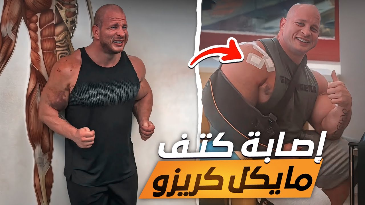 إصابة واحدة تضيع جسم لاعب كمال أجسام محترف - مايكل كريزو