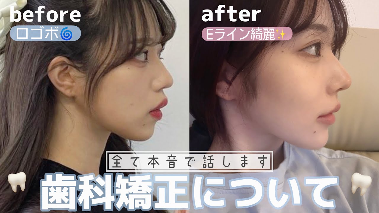 整形レベルで変われる方法🫶‼️若いうちに綺麗を追求して自己肯定感あげてこ🎶