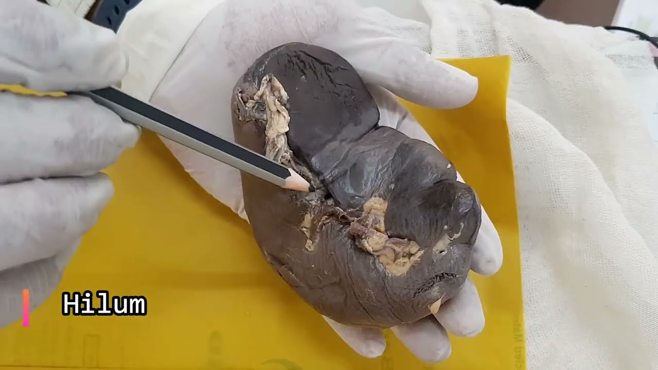 Spleen | Anatomical Position  | Parts | Relations | Applied Anatomy