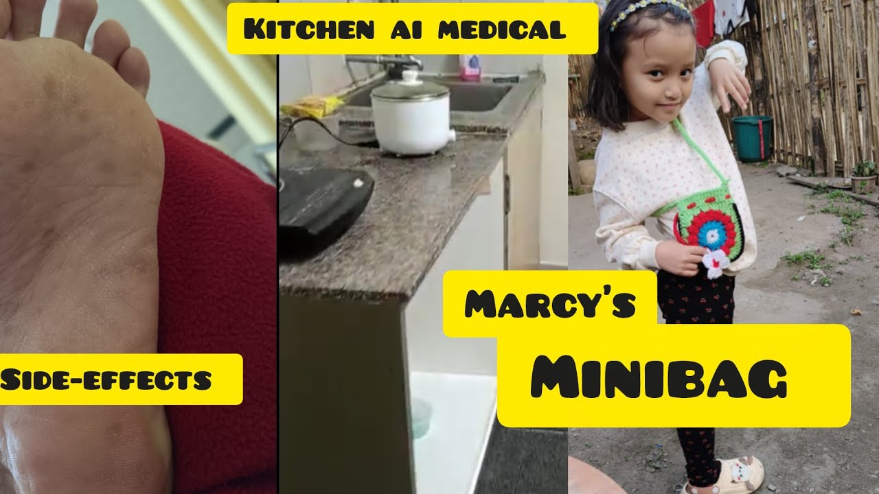 Chemo side-effects 😡😡n dnt miss tatkiim's gejubura🤣🤣
