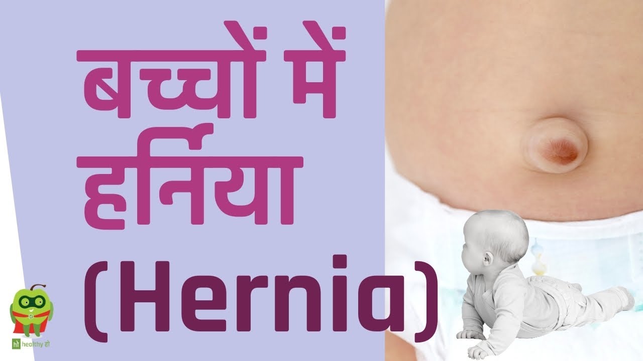 बच्चों में हर्निया (Hernia) - लक्षण | कारण | उपचार - Umbilical Hernia