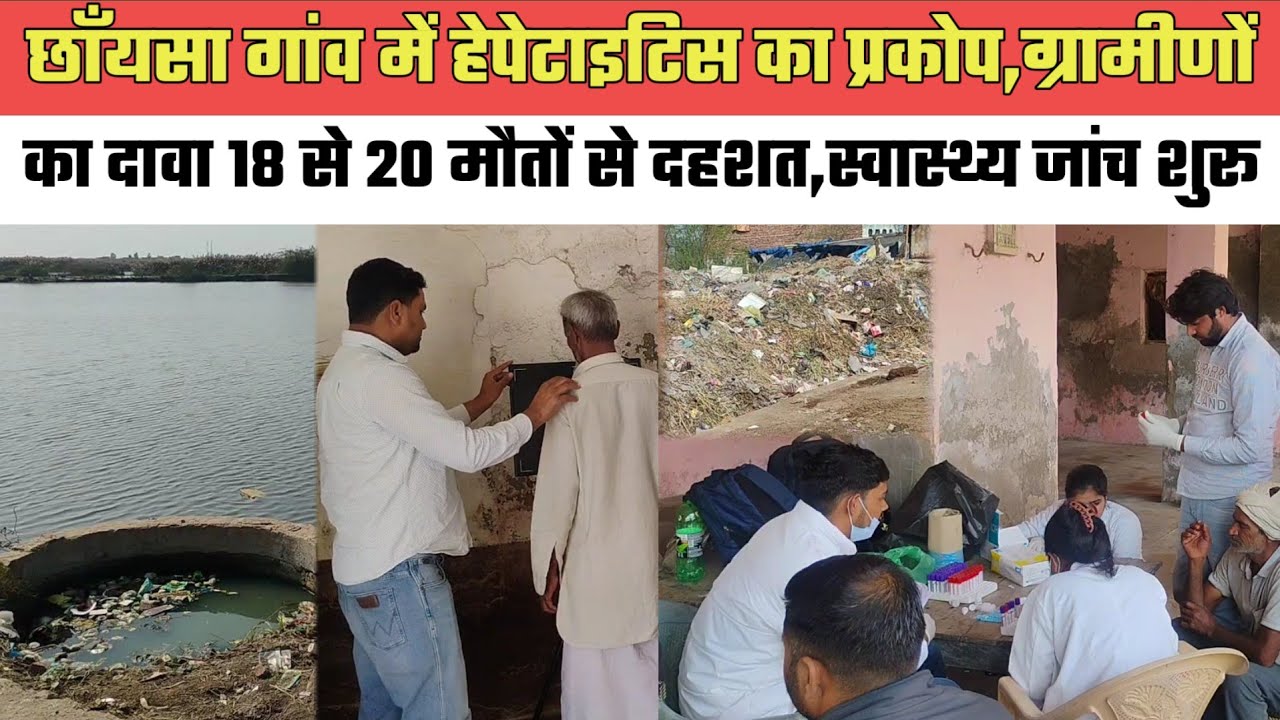छाँयसा गांव में हेपेटाइटिस का प्रकोप,ग्रामीणों का दावा 18 से 20 मौoतों से दहशत,स्वास्थ्य जांच शुरू