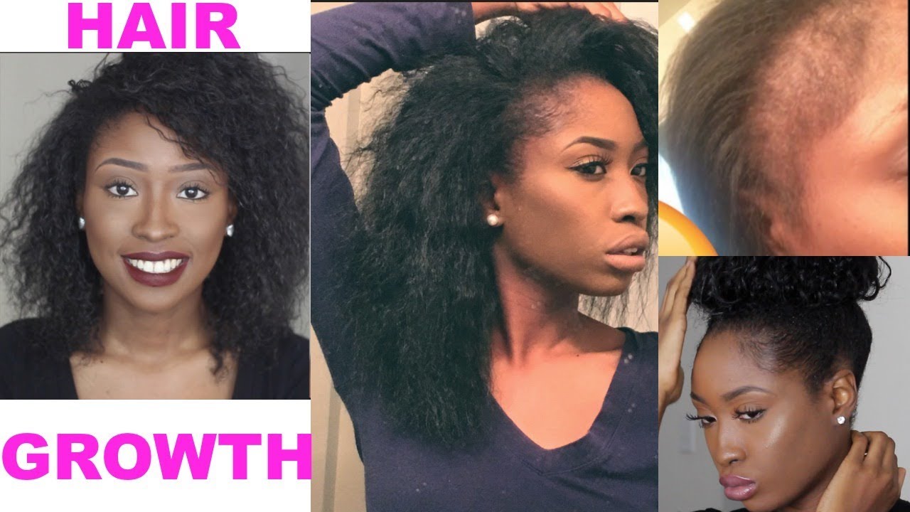 HOW I GREW MY HAIR & BALD EDGES BACK! Natural Hair length check & products!
