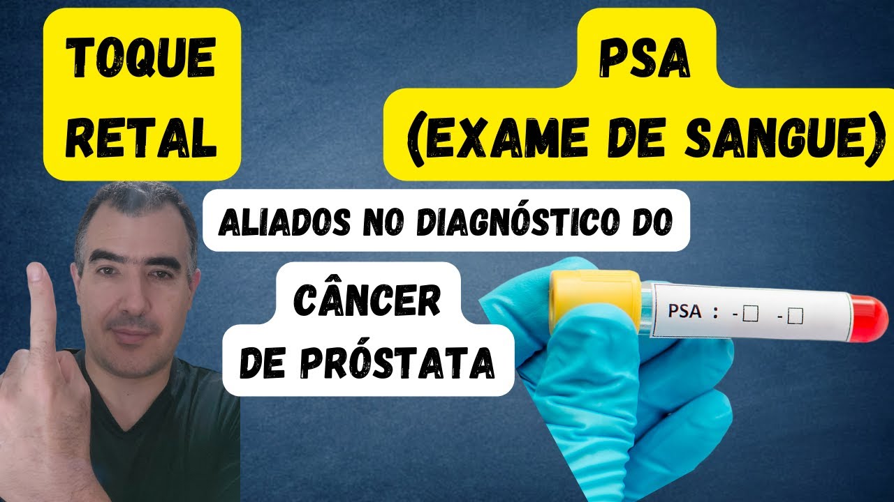 Exame de Pr&oacute;stata X PSA total: por que &eacute; necess&aacute;rio realizar os dois exames?
