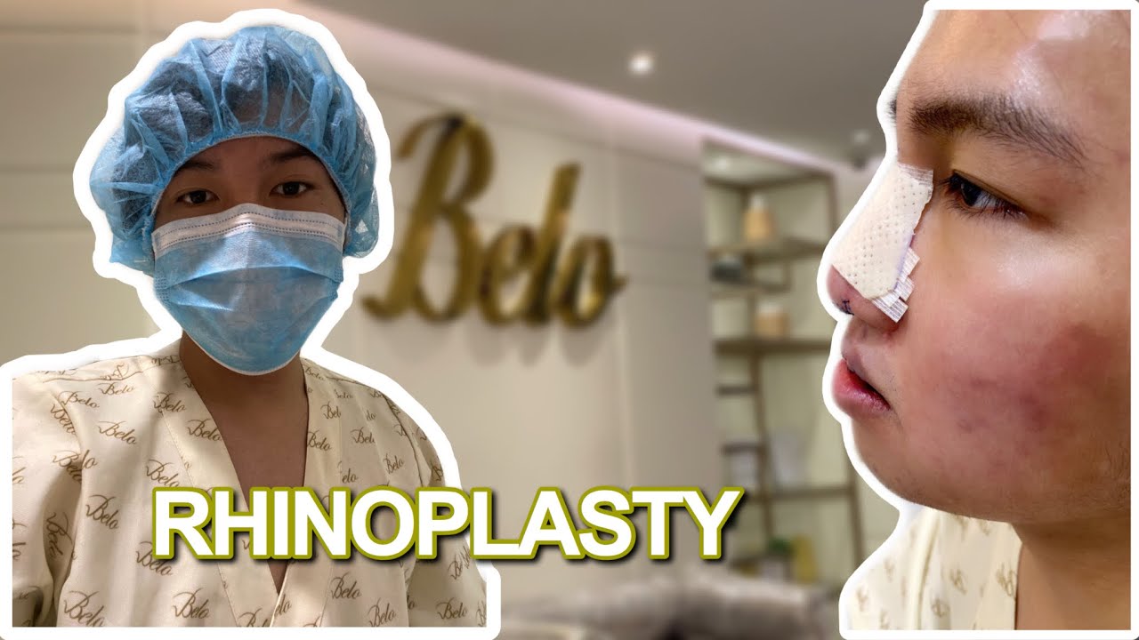I GOT A NOSE JOB (RHINOPLASTY) AT BELO MEDICAL | Keith Ygana