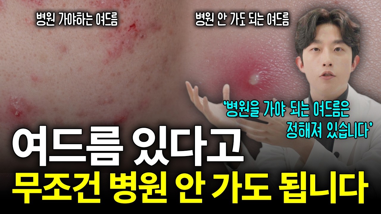 여드름 있으시면 필수시청! 여드름 고민 이 영상 하나로 끝내세요!