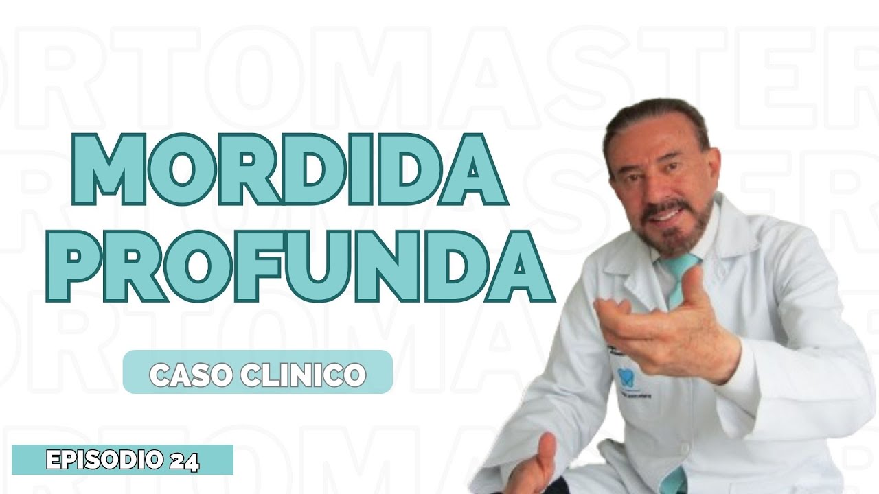 mordida profunda 👄 - Episodio 24
