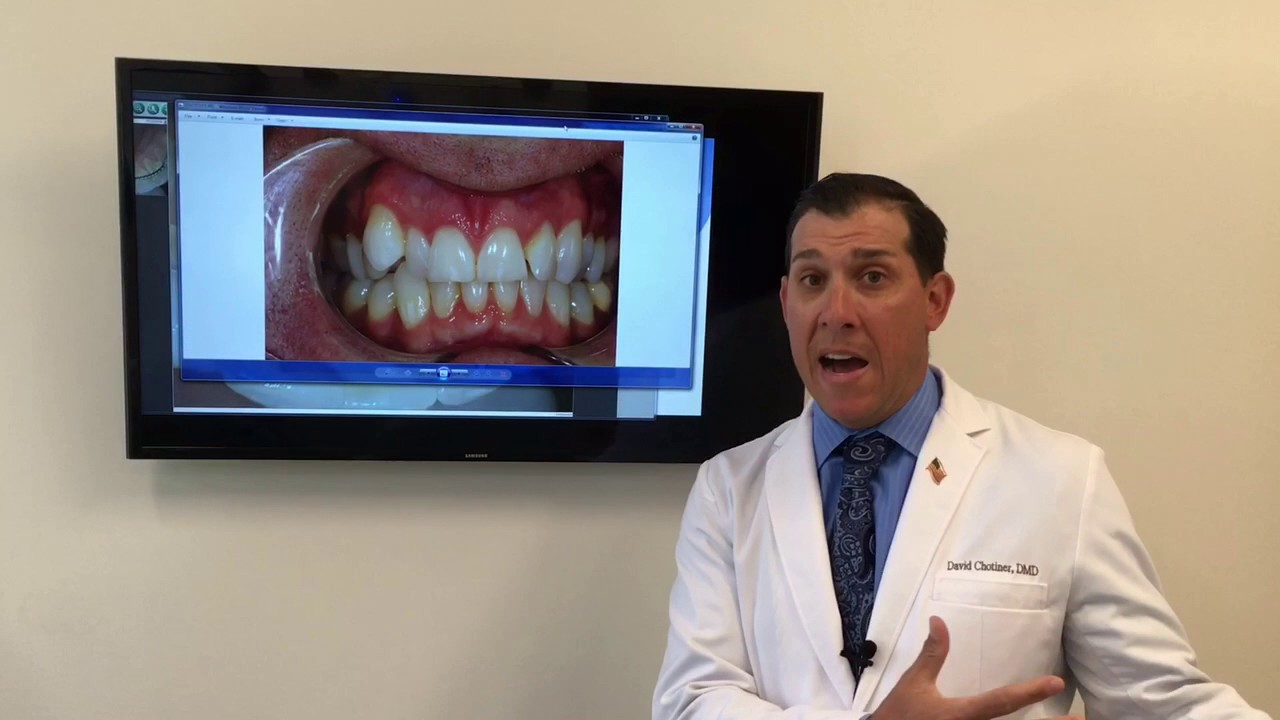 3 Step Dental Treatment Planning in San Diego