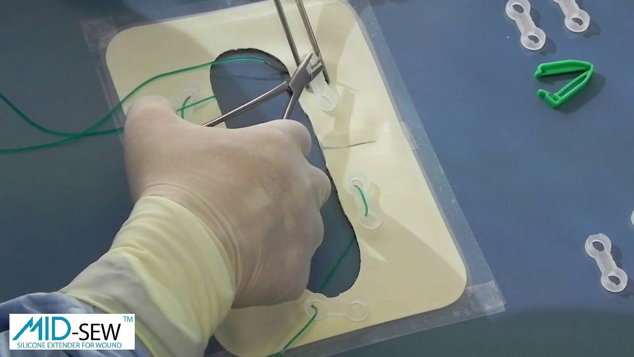 The Silicone Extender for Wound MID-SEW TM - MID
