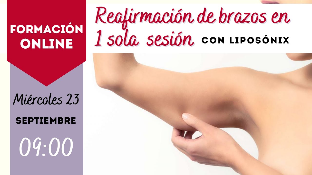 Reafirmación de brazos en 1 sesión con Liposonix (H.I.F.U.)