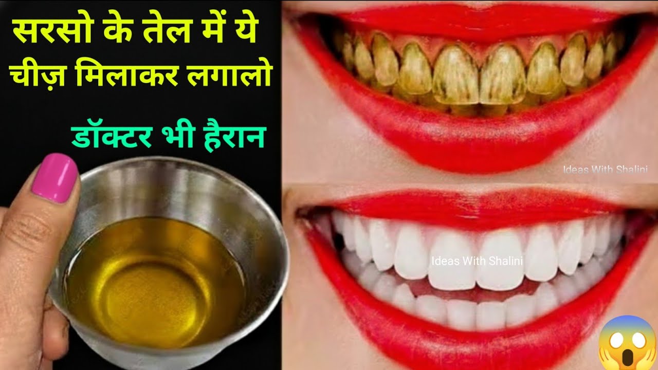 सिर्फ 5 रूपये में गंदे पीले दांतों को मोती की तरह चमका देगा / Teeth whitening remedy /dato ko white