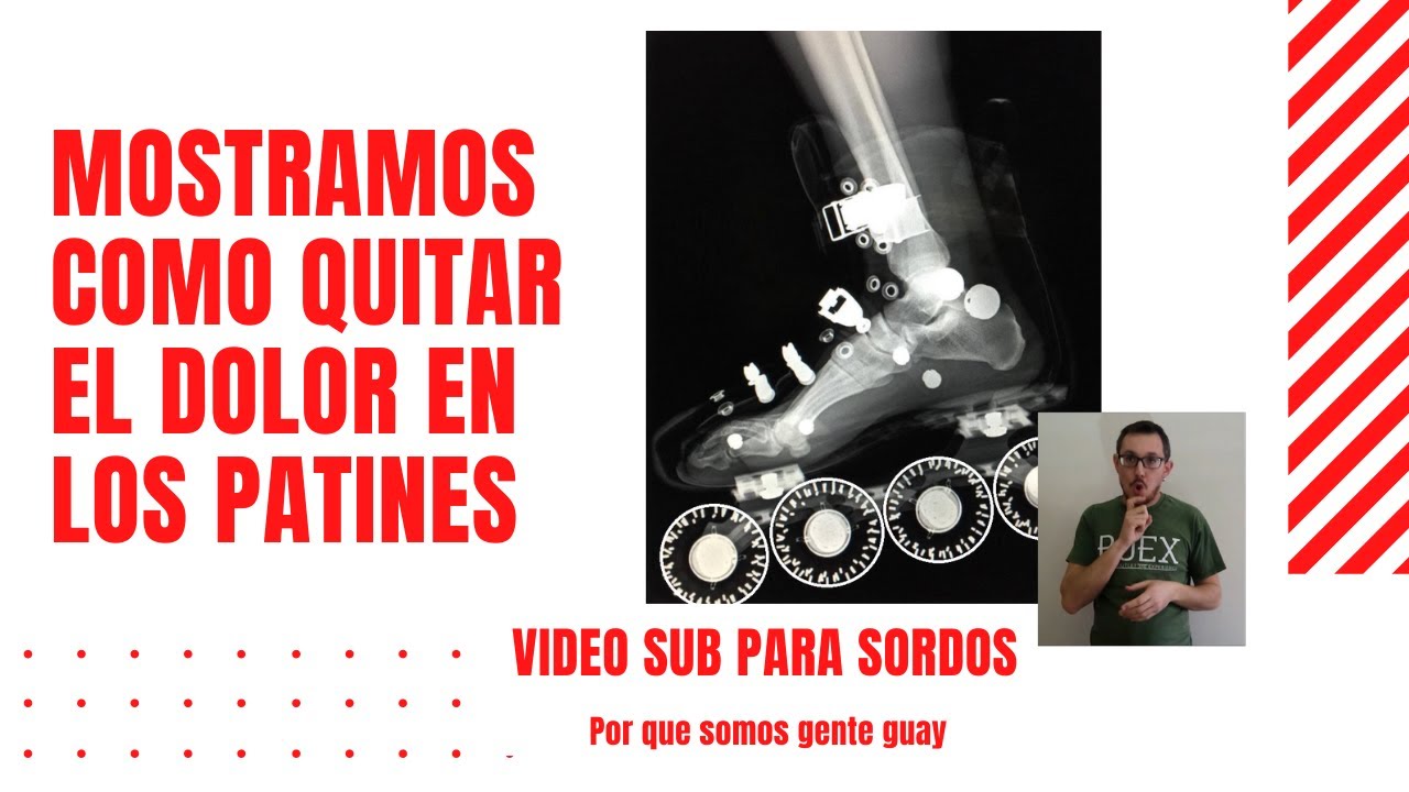 Guía DEFINITIVA!!!! 💥 Solucionamos el DOLOR de los Patines
