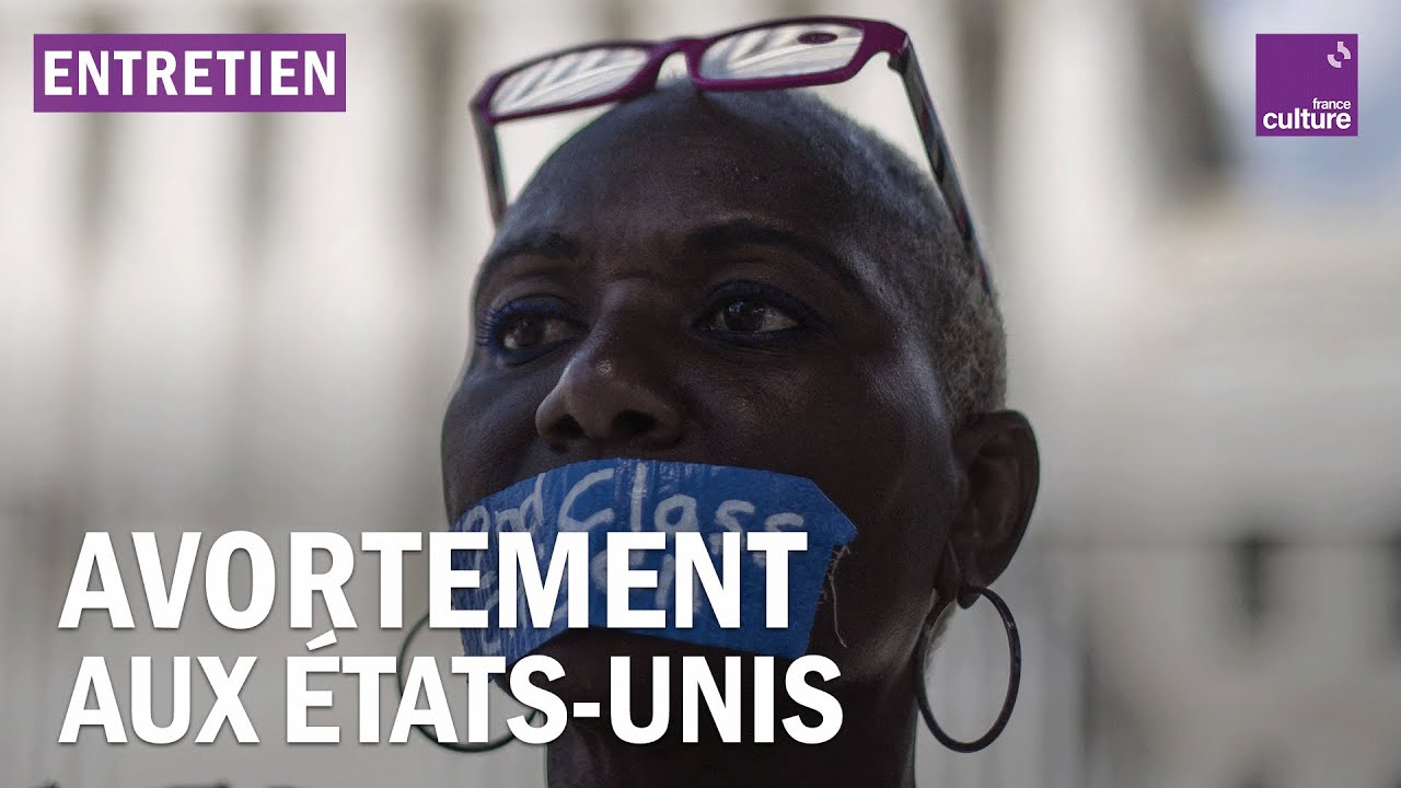IVG aux États-Unis : 