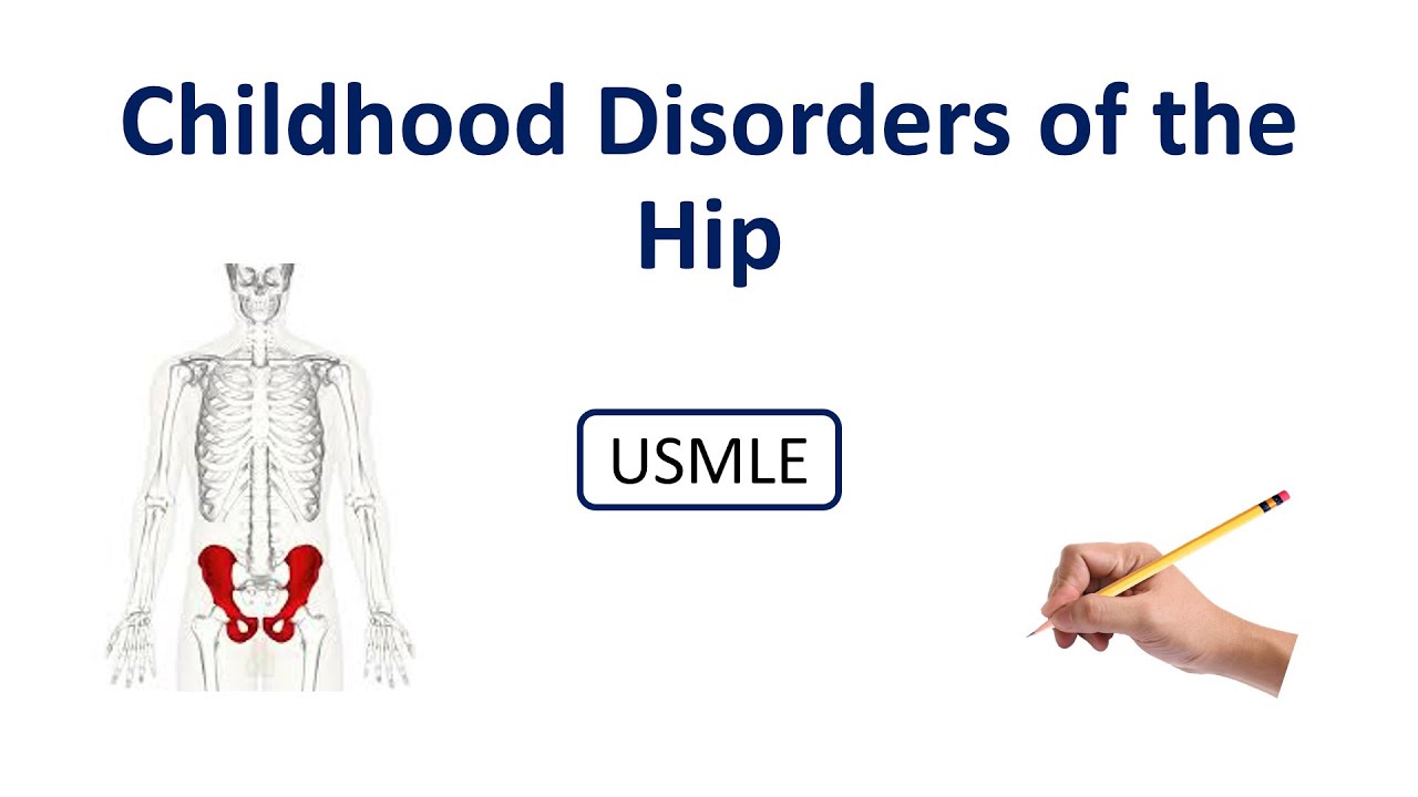 Childhood Disorders of the Hip Made Super Easy