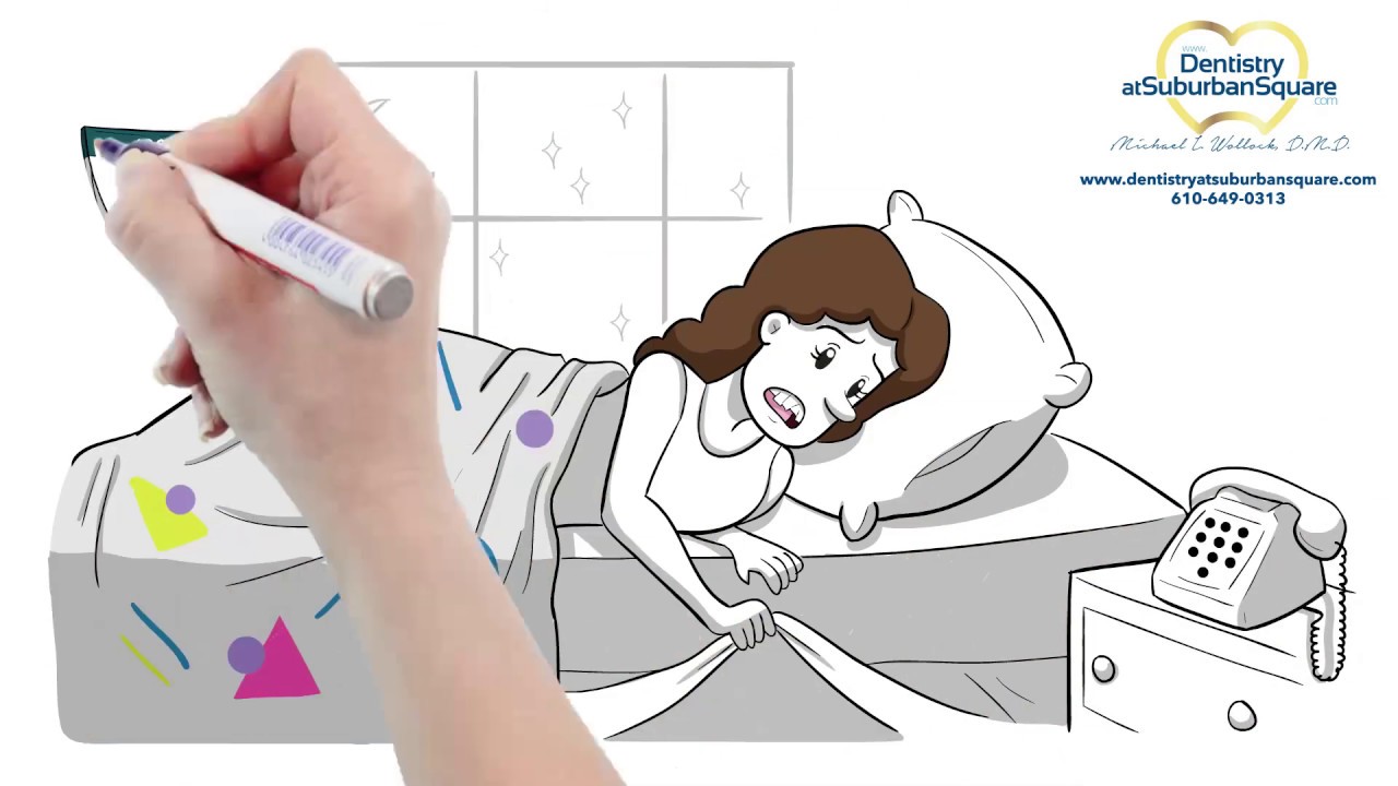 Vivera Retainers: Everything You Need to Know About Keeping Your Smile in Place After Invisalign