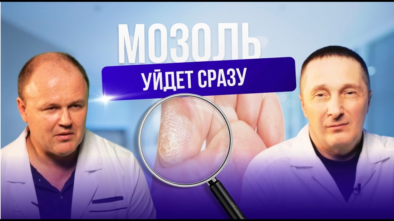 Как избавиться от мозолей навсегда?