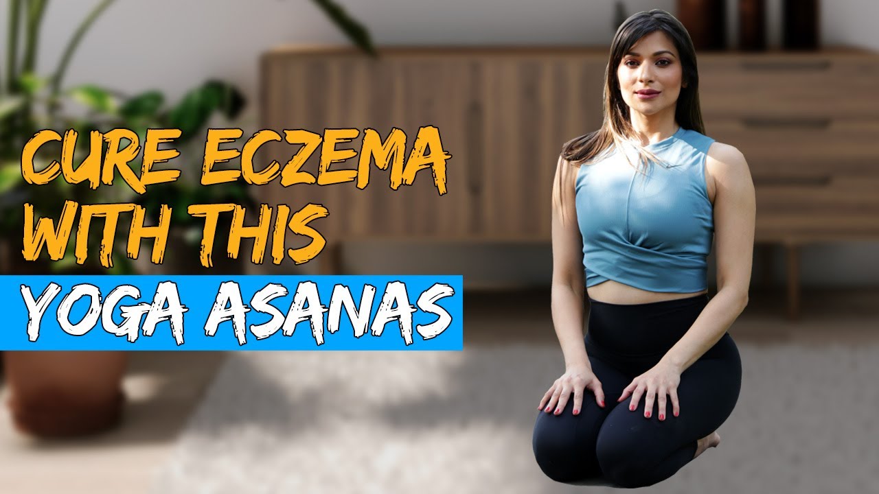 Yoga To Treat Eczema Naturally | Fit Tak