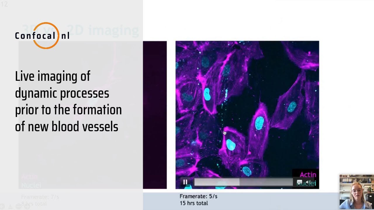 Live imaging of dynamic processes prior to the formation of new blood vessels with Maxime Cammeraat