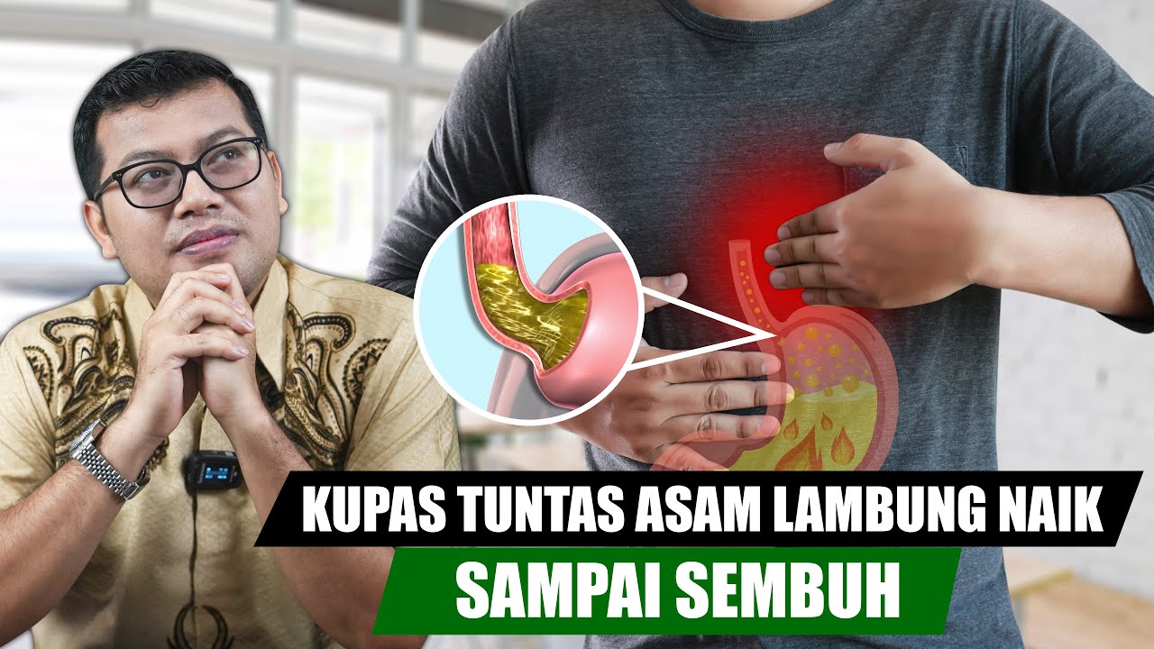 PENYEBAB DAN CARA MENGATASI GERD ASAM LAMBUNG NAIK - DOKTER SADDAM ISMAIL