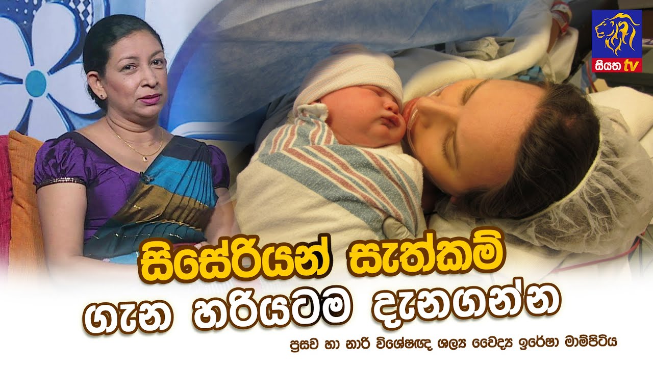 සිසේරියන් සැත්කම් ගැන හරියටම දැනගන්න | Iresha Mampitiya | Adaraneeya Jeewithaya