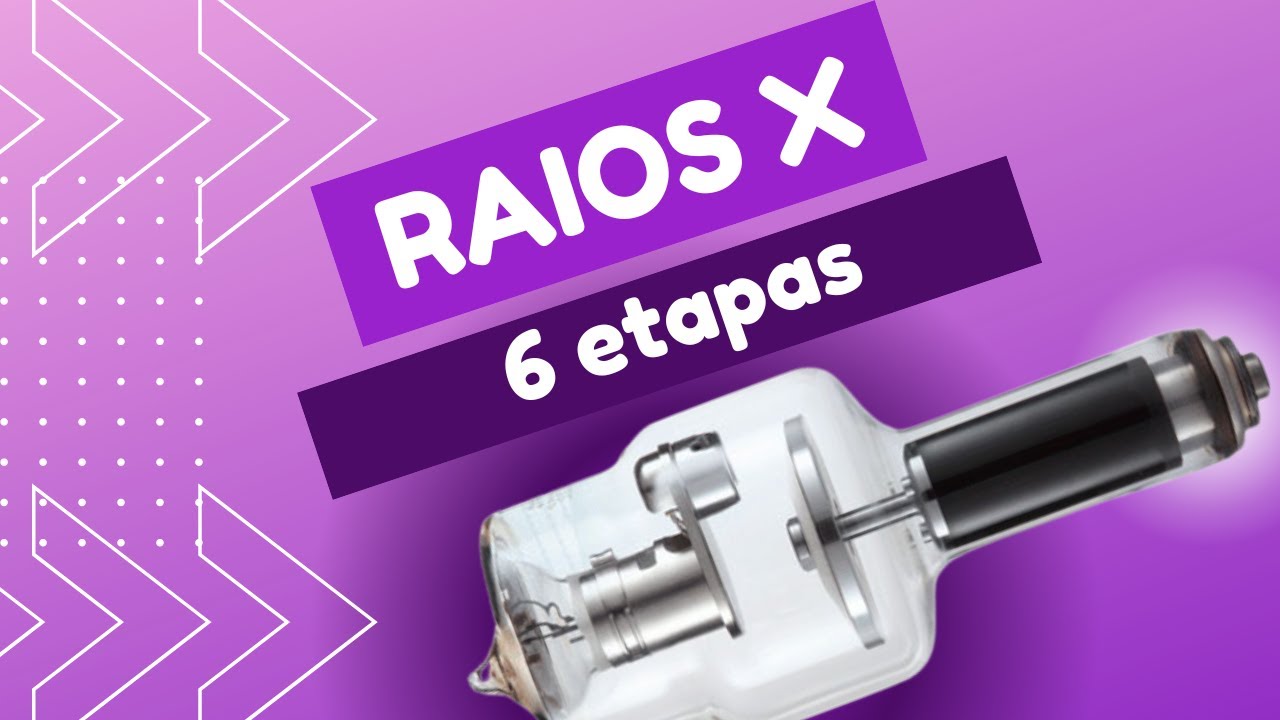A PRODU&Ccedil;&Atilde;O DE RAIOS X EM 6 ETAPAS [POR ACADEMIA DE RADIOLOGIA]