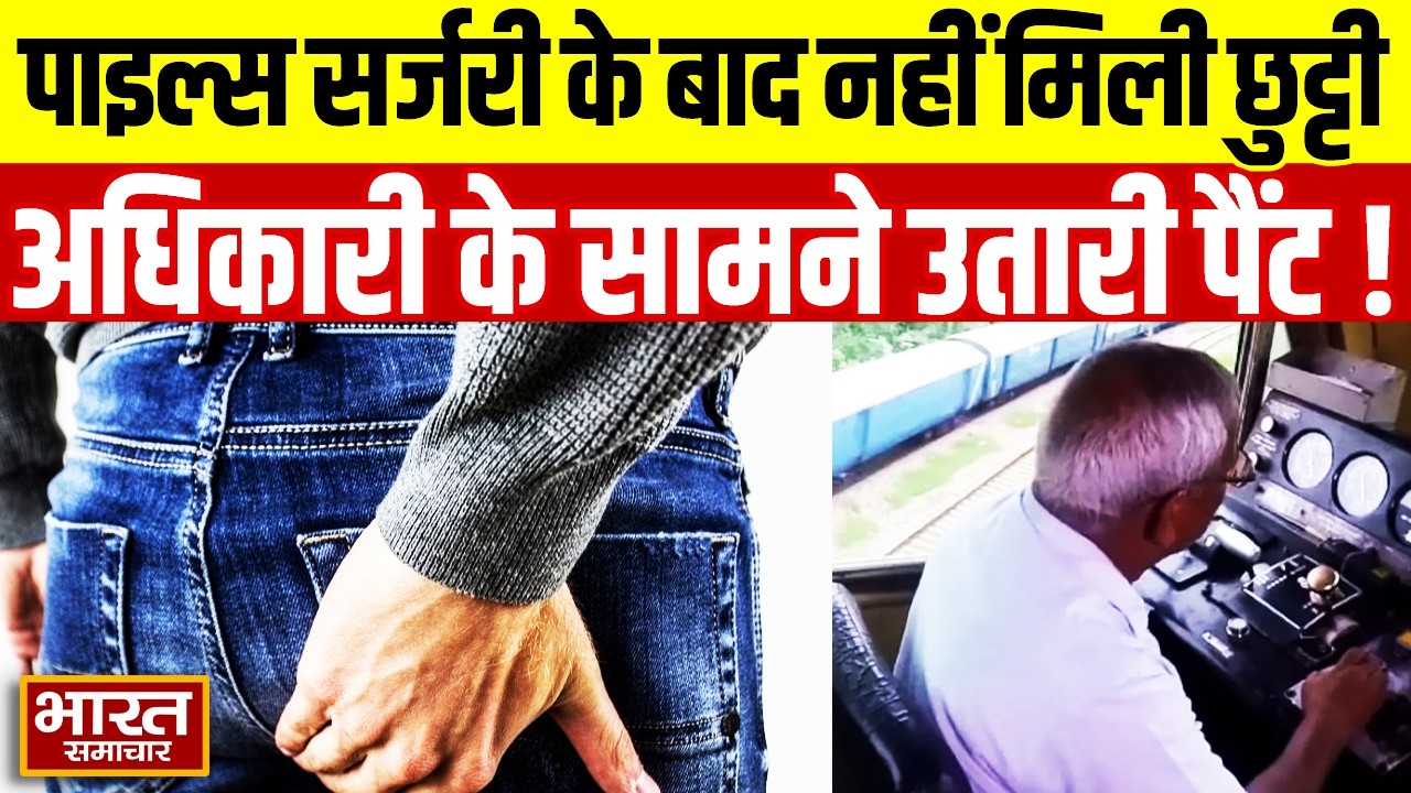 Lucknow News: पाइल्स सर्जरी के बाद छुट्टी नहीं मिली, लोको पायलट ने अधिकारी के सामने उतारी पैंट!