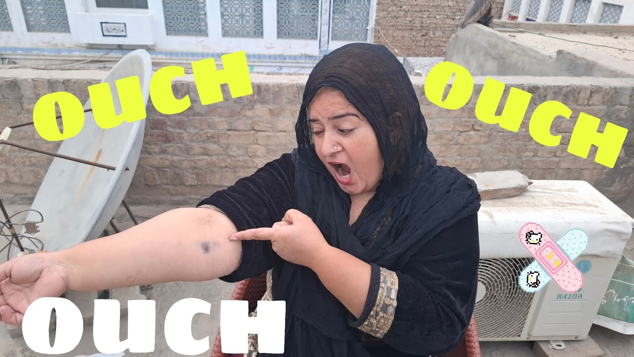OUCH OUCH OUCH OUCH 😕 || Mama Ki Arm Par Ajeeb Sa Mark Ban Gaya || @Salmanmalikvlogs5 