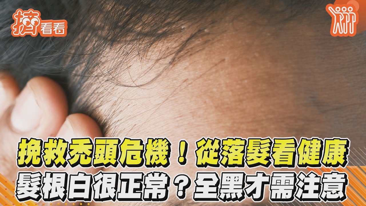 挽救禿頭危機! 從落髮看健康 髮根白很正常?全黑才需注意｜TVBS新聞｜擠看看