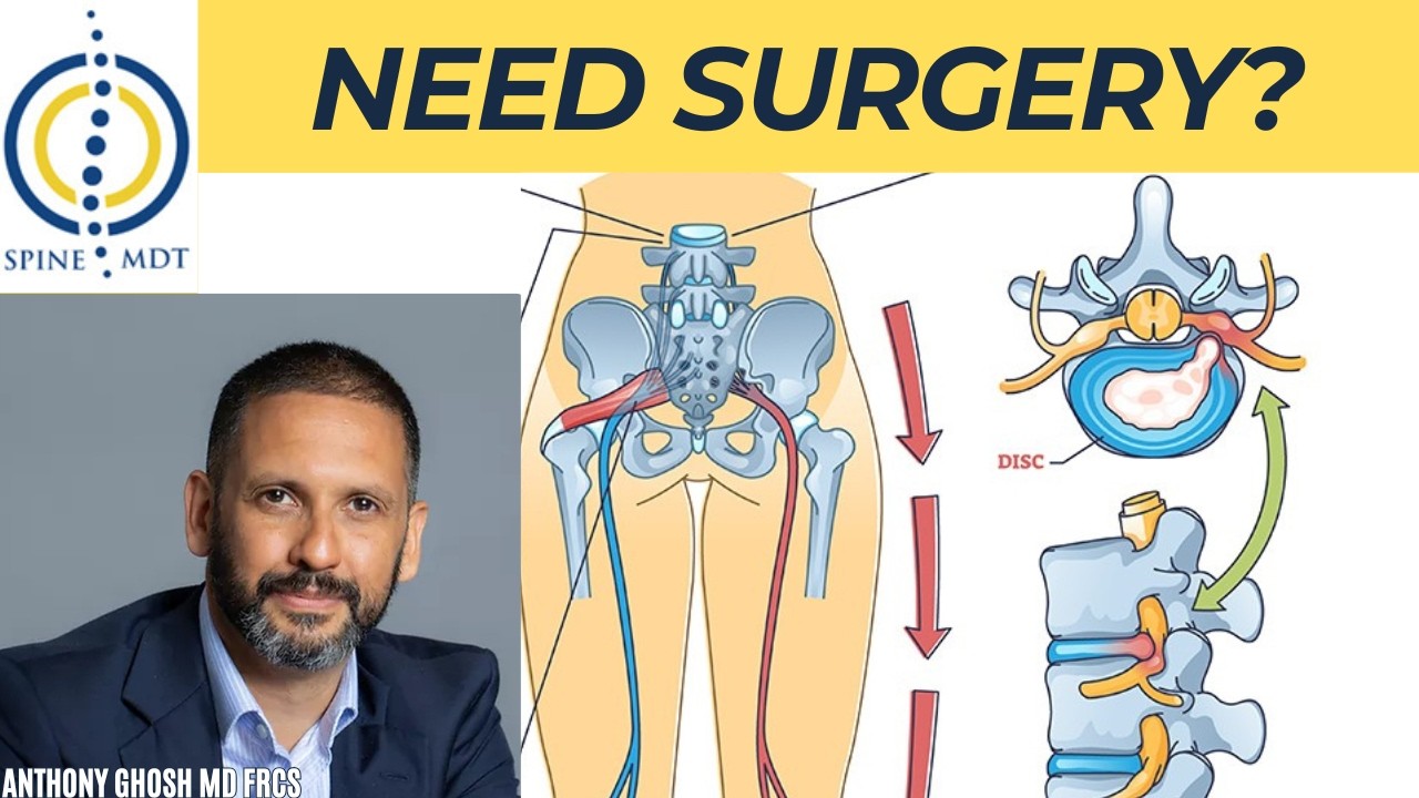 When Nerve Compression Actually Needs Surgery