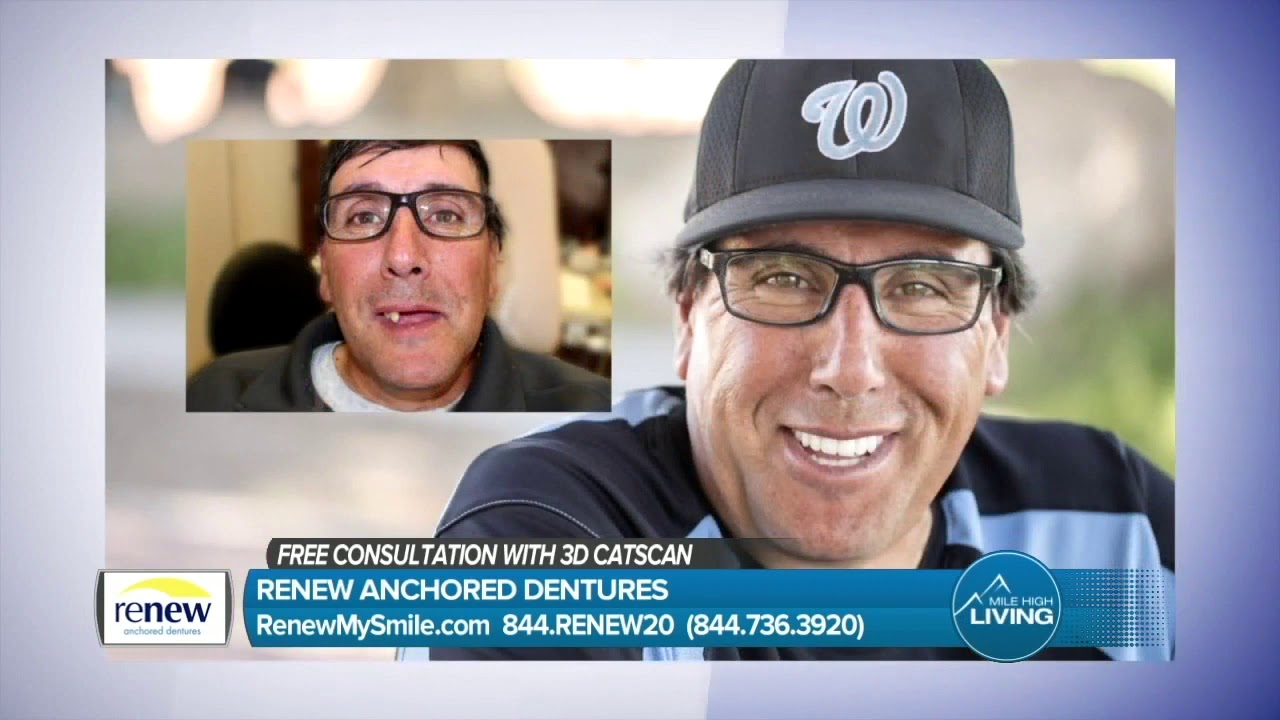 Renew Dental- Cost-Effective Option For A Bright New Smile