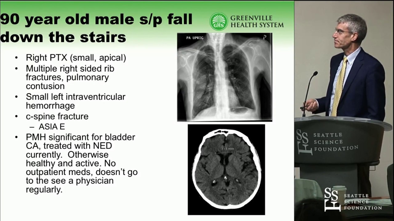 Spine Trauma in the Aging - Timothy McHenry, MD