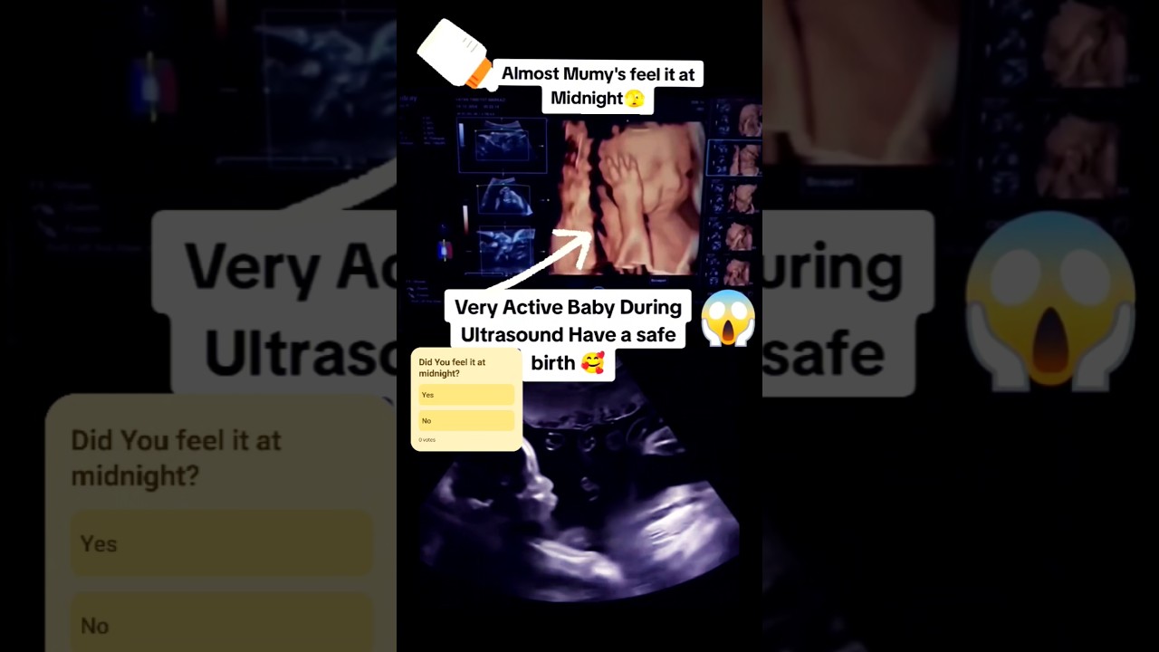 Very active baby movements during live ultrasound😱|#pregnancy
