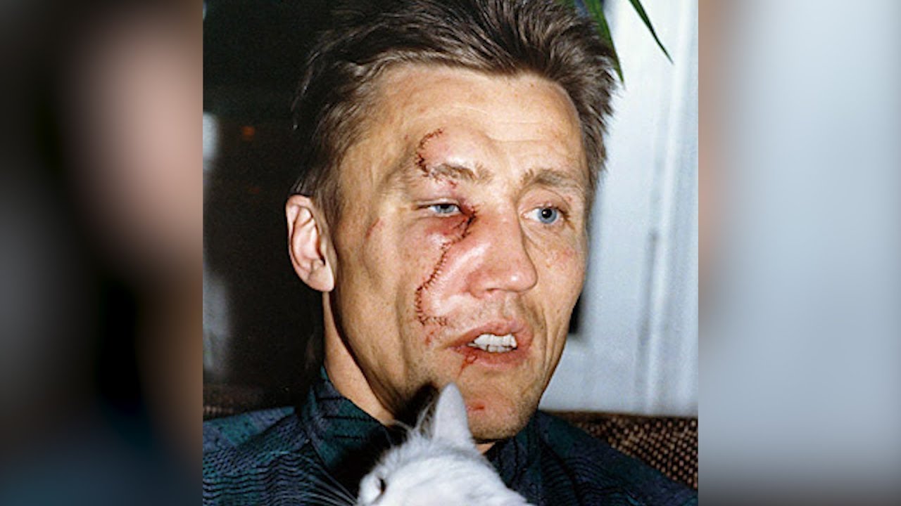 9 cringe-worthy hockey injuries..in 90 seconds