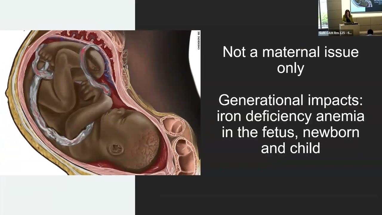 MCHRI Seminar Series: Iron Deficiency Anemia in Pregnancy