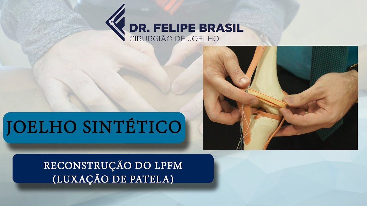 CIRURGIA PARA LUXAÇÃO (INSTABILIDADE) DA PATELA - WORKSHOP