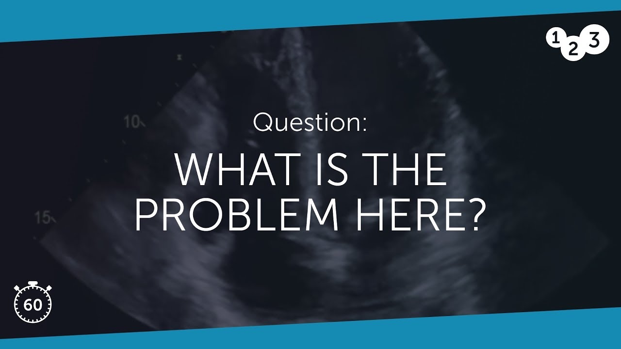 60 Seconds of Echo Teaching Question: What is the problem here?
