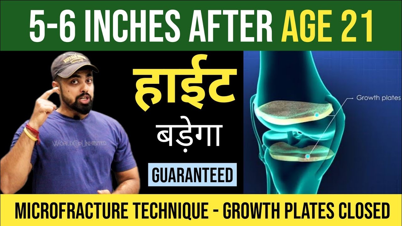 12 Exercises To Increase Height After 21 | Microfracture Technique