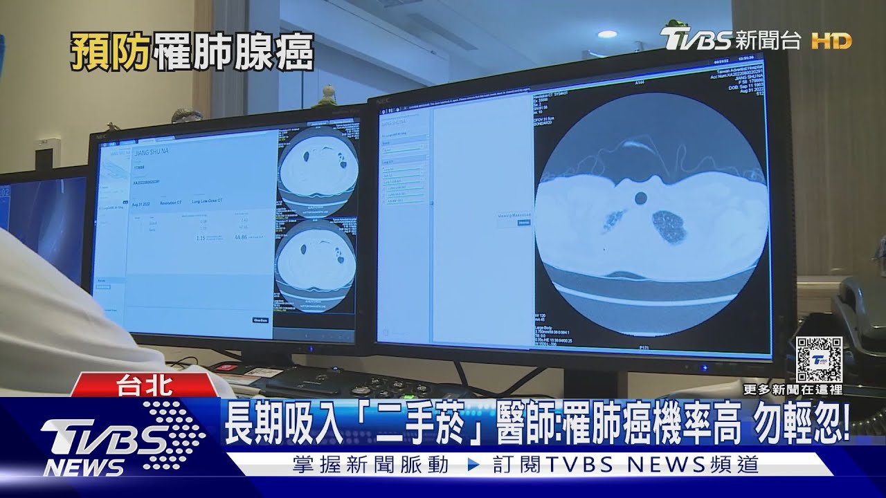 不吸菸...為何「罹肺癌」...關鍵是「這原因」醫:致死率高!｜十點不一樣20240731 @TVBSNEWS01